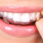 Tipos de ortodoncia invisible